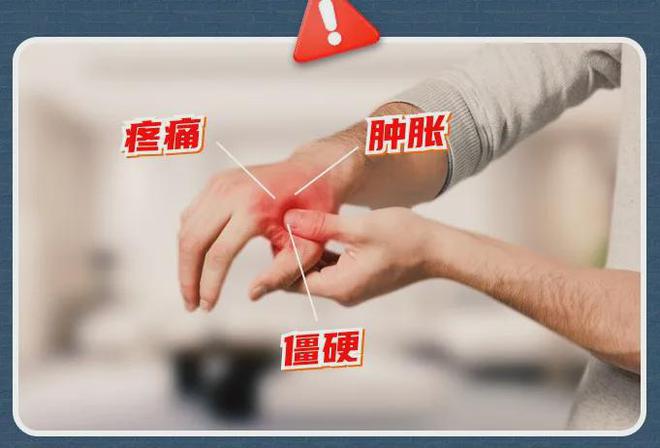 酸、手麻、腱鞘问题推荐用它！千亿球友会小米生态杀疯了！手
